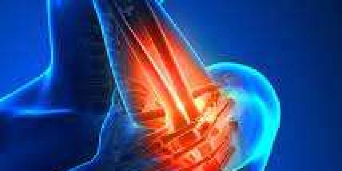 Chronic Joint Pain and Dietary Choices